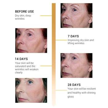 BREYLEE Kolagen Serum, Učvrstitev in Glajenje Kože Serum Vlažilna Vlažilne Anti-aging Odstranjevanje Gub Care15ml