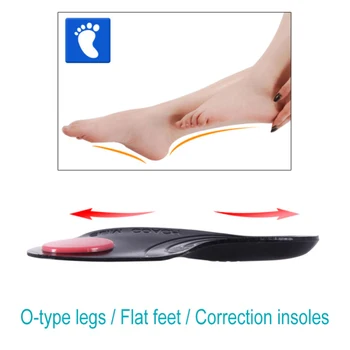 Silikonski Flatfoot Korektor Vložki za U/O Type Noge Popravek Ravno Stopala Arch Podporo Ortopedski Čevlji Vložki Gel Blazina Pad