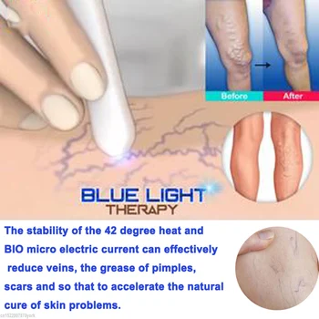 1pc Medicinske Modra Svetloba Terapija Laser Pero dodaj 1Pc Krčne Žile Zdravljenje Krema za Mehko Brazgotina Gubam Odstranitev Zdravljenje Samo 7 Dni